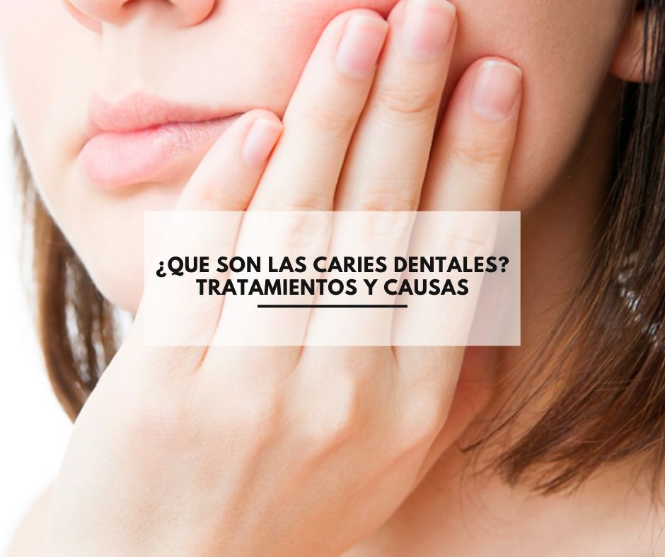 ¿Qué son las caries dentales? Tratamientos y causas ¿Qué son las caries dentales? Tratamientos y causas