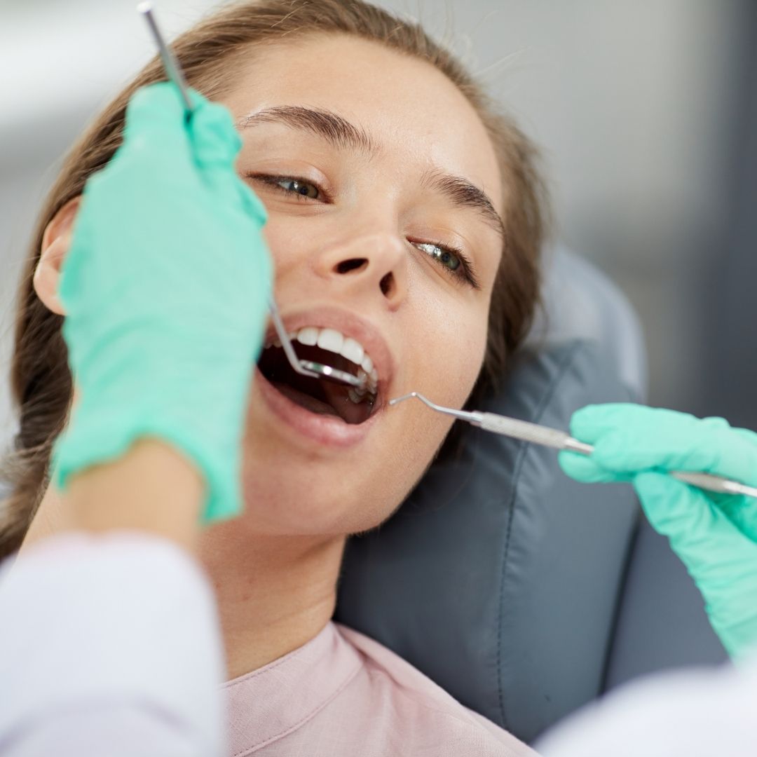 caries de raíz