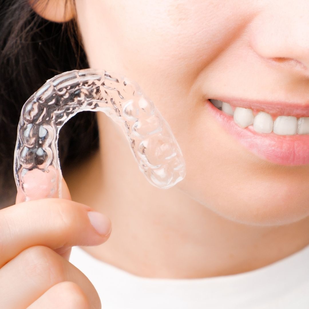 Para aumentar mental amor Los muchos beneficios de los protectores bucales | Dentista Talavera